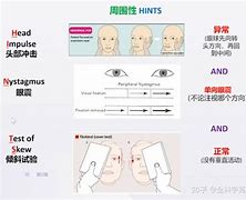 眩晕：如何通过视听语言重现精神困境